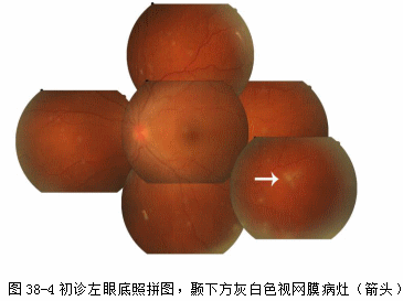 ZY016_202_5.gif